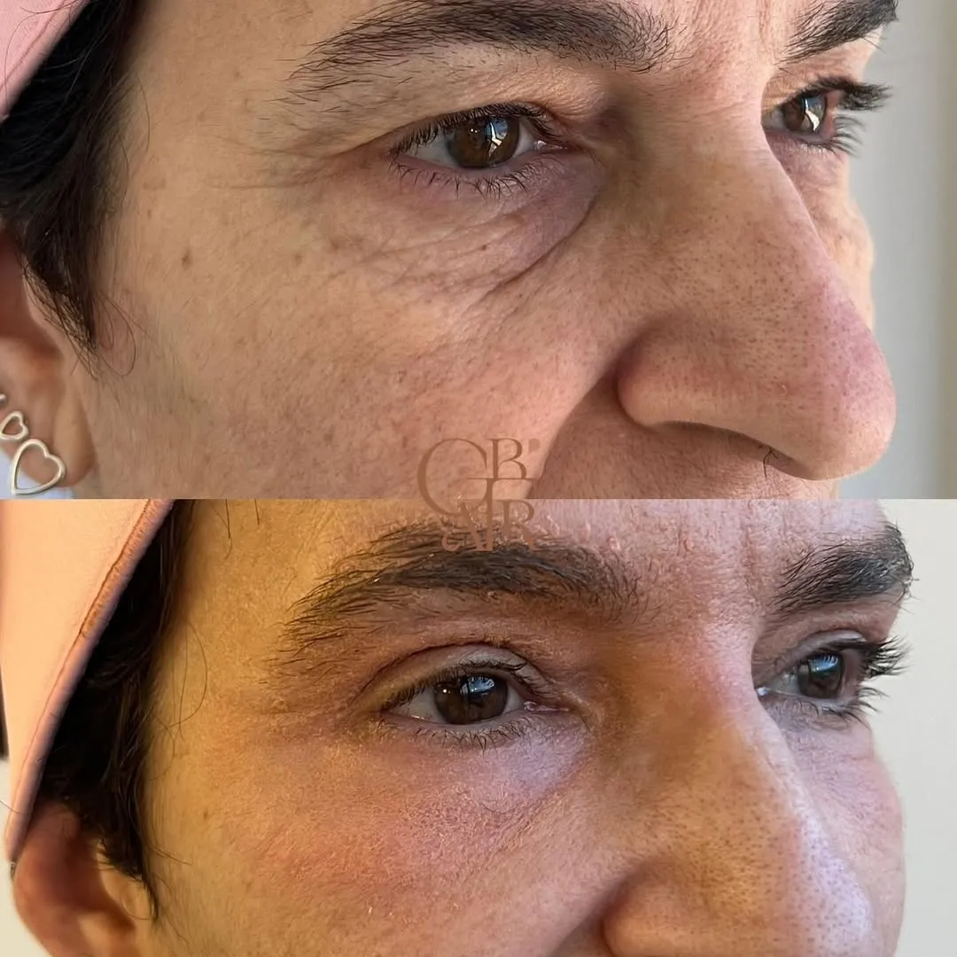 Antes e depois — resultado real 3