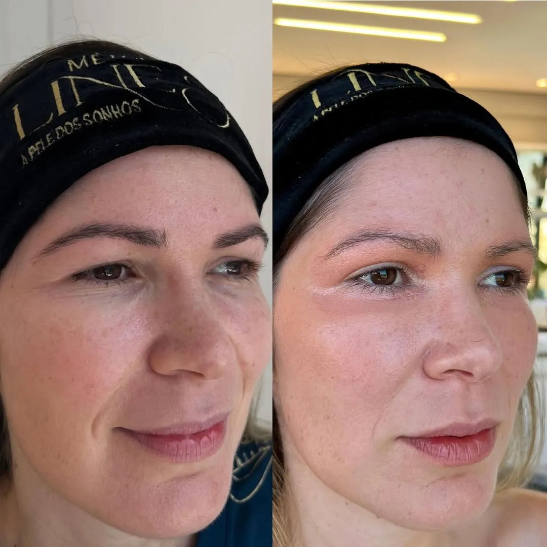 Antes e depois — resultado real 5