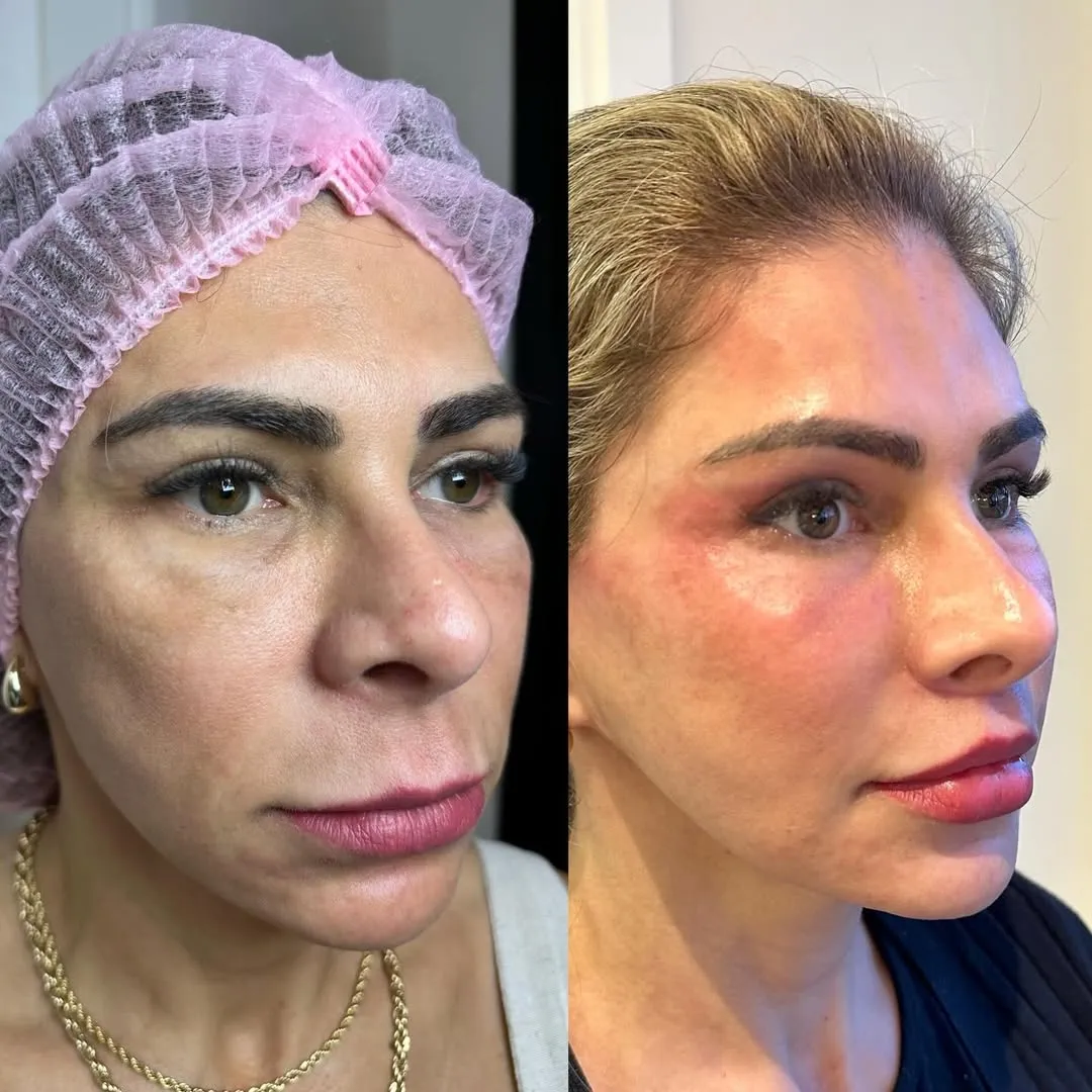 Antes e depois — resultado real 6