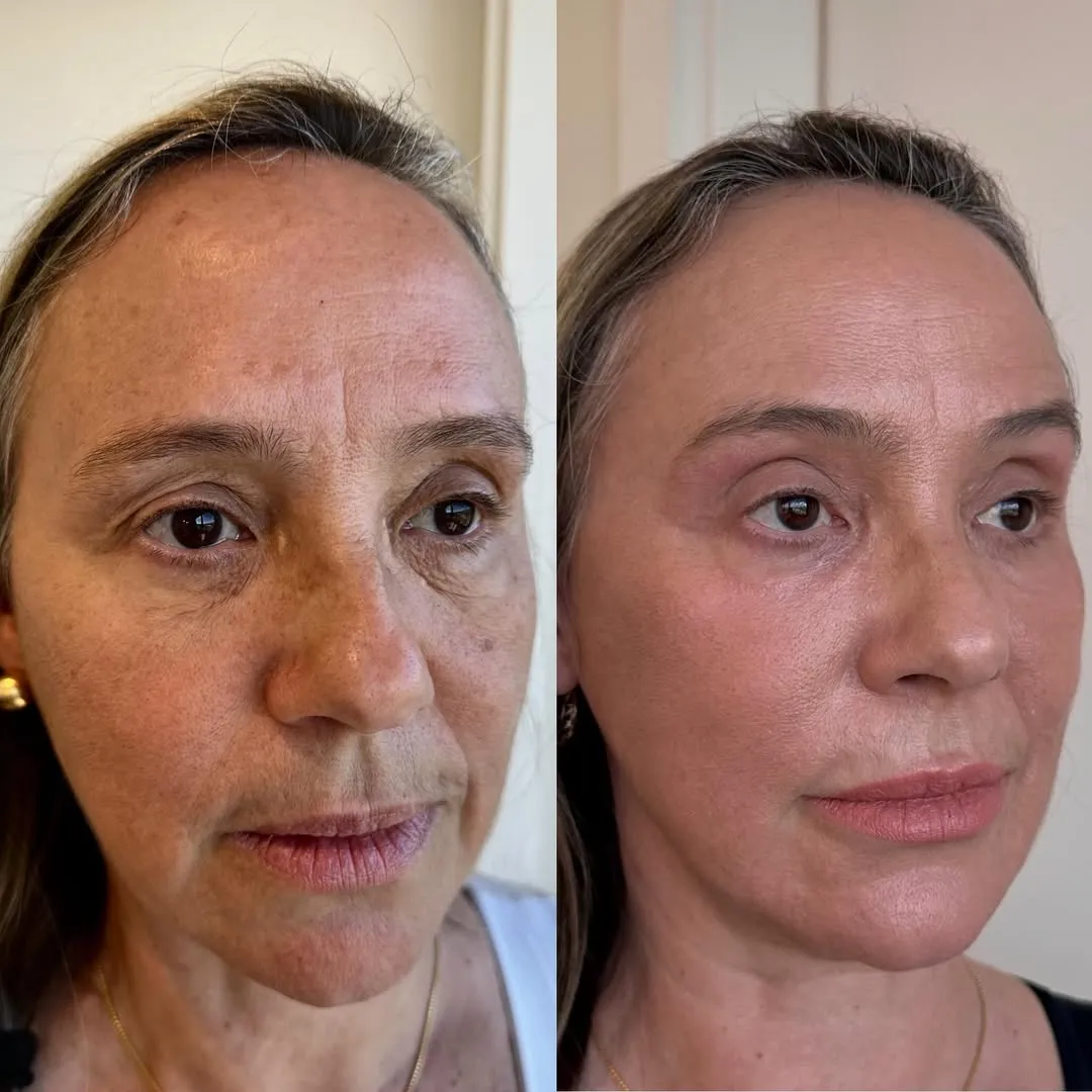 Antes e depois — resultado real 7