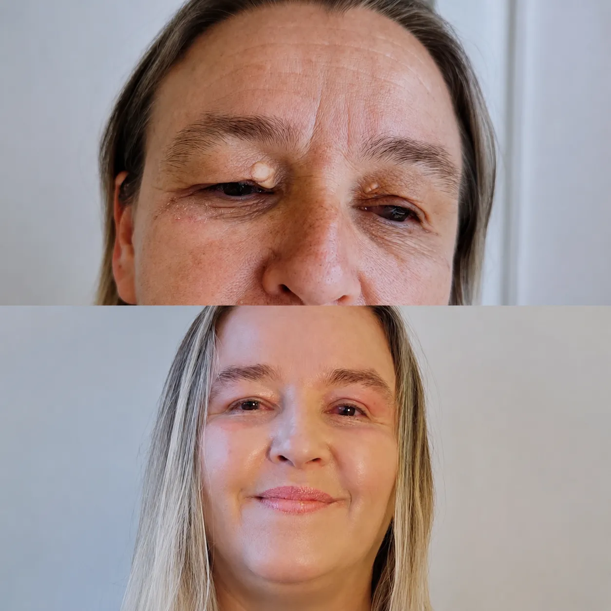 Antes e depois — resultado real 8