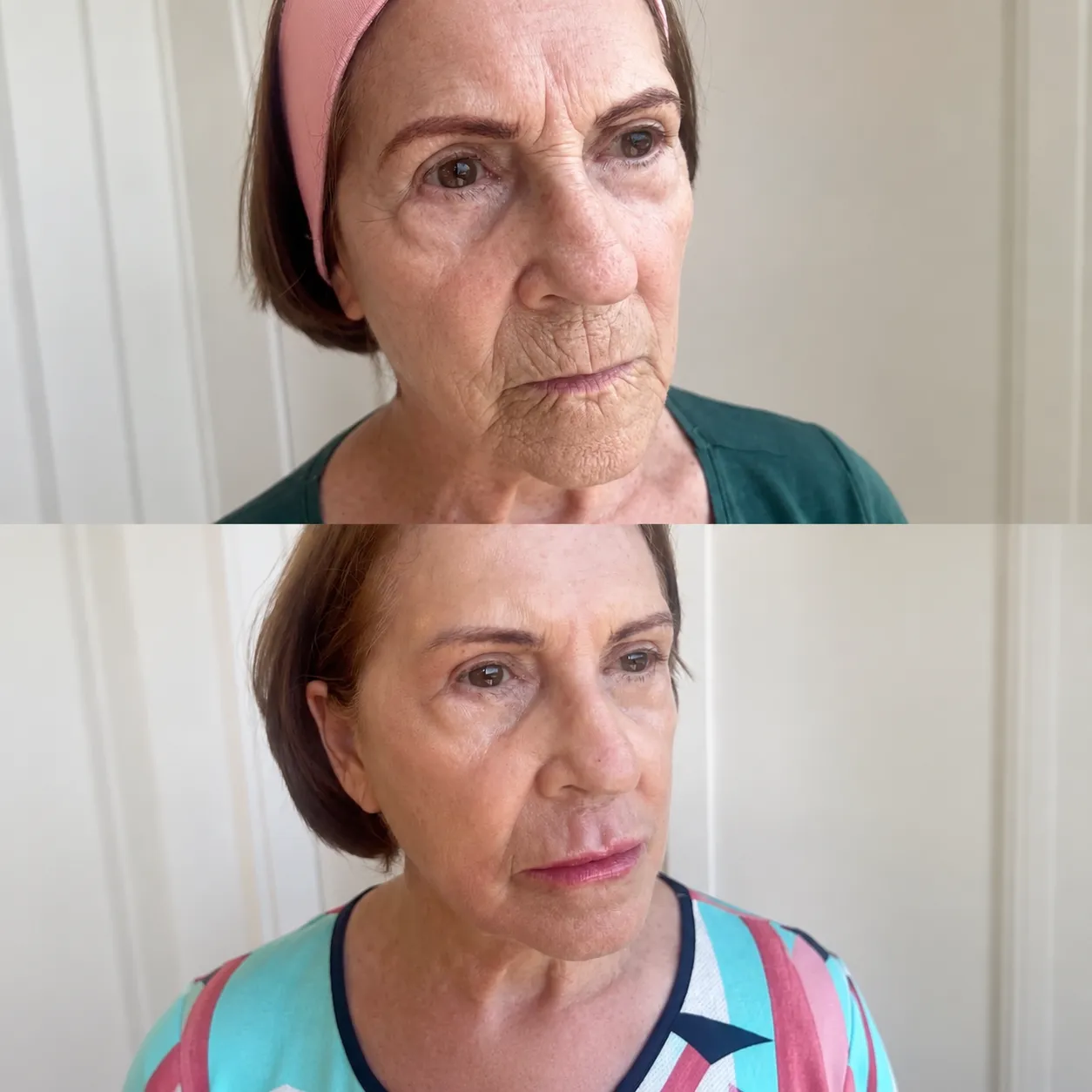Antes e depois — resultado real 9